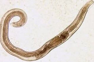 Parasites of a human cutter