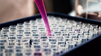 How to do tests to detect pests in the body